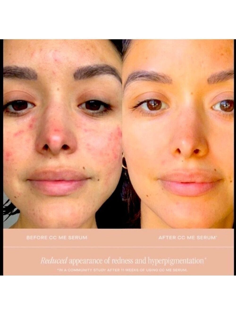 Summer Fridays Vitamin C Serum Antioxidant Niacinamide Collagen - Picture 2 of 9